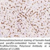 FcγRIIIa/CD16a Polyclonal Antibody (FCG3, FCGR3A, FCR-10, FCRIIIa, FGR3A)