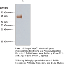 Asialoglycoprotein Receptor 1 Rabbit Monoclonal Antibody (Clone 021)