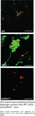 Ganglioside GM1 Monoclonal Antibody (Clone DG1)