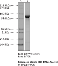 thioredoxin glutathione Involvement of glutaredoxin-1 and thioredoxin-1 in β-amyloid toxicity and  Alzheimer's disease main image 1