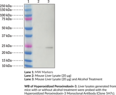 全国送料無料・イイ店 Peroxiredoxin-3 Hyperoxidized Monoclonal (Clone Antibody リラクゼーショングッズ