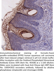 Oxidized Phospholipid Monoclonal Antibody (Clone 509) (OxPL)