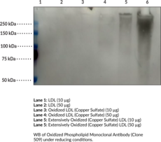 Oxidized Phospholipid Monoclonal Antibody (Clone 509)