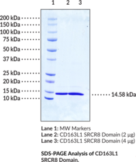 CD163L1 SRCR8 Domain (human, recombinant) (CD163B, CD163L1, CD163 Antigen B, CD163 Antigen-like 1, CD163 Molecule-like 1, hCD163L SRCR8, M160, Scavenger Receptor Cysteine-rich Type 1 Protein M160)