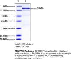 IGF2BP2 Long Isoform (human, recombinant) (IGF2 mRNA-binding Protein 2, Insulin-like Growth Factor 2 mRNA-binding Protein 2, IMP-2, VICKZ2)