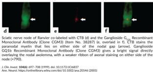 Ganglioside GQ1b Recombinant Monoclonal Antibody (Clone CGM3) (Tetrasialoganglioside GQ1b)