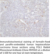 FGL1 Rabbit Monoclonal Antibody (Clone RM502)