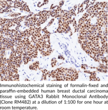 GATA3 Rabbit Monoclonal Antibody (Clone RM482)