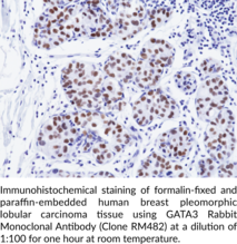 GATA3 Rabbit Monoclonal Antibody (Clone RM482)