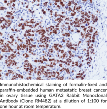 GATA3 Rabbit Monoclonal Antibody (Clone RM482)