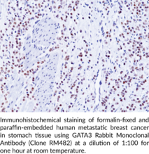 GATA3 Rabbit Monoclonal Antibody (Clone RM482)