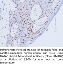 GATA3 Rabbit Monoclonal Antibody (Clone RM482)