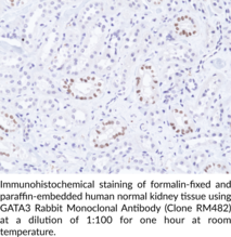 GATA3 Rabbit Monoclonal Antibody (Clone RM482)