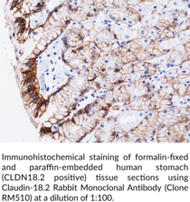 Claudin-18.2 Rabbit Monoclonal Antibody (Clone RM510) (Claudin-18.A2, Claudin 18 isoform 2)