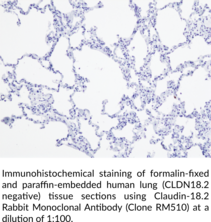 Claudin-18.2 Rabbit Monoclonal Antibody (Clone RM510)