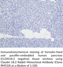 Claudin-18.2 Rabbit Monoclonal Antibody (Clone RM510)