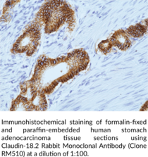 Claudin-18.2 Rabbit Monoclonal Antibody (Clone RM510)