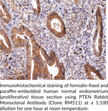 PTEN Rabbit Monoclonal Antibody (Clone RM511) (MMAC1, Mutated in Multiple Advanced Cancers 1, Phosphatase and Tensin Homolog, TEP1)