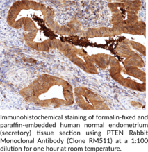 PTEN Rabbit Monoclonal Antibody (Clone RM511)