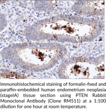 PTEN Rabbit Monoclonal Antibody (Clone RM511)