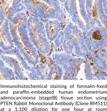 PTEN Rabbit Monoclonal Antibody (Clone RM511)
