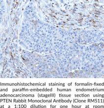 PTEN Rabbit Monoclonal Antibody (Clone RM511)
