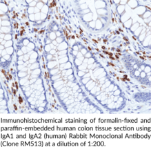 IgA1 and IgA2 (human) Rabbit Monoclonal Antibody (Clone RM513)