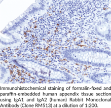 IgA1 and IgA2 (human) Rabbit Monoclonal Antibody (Clone RM513)