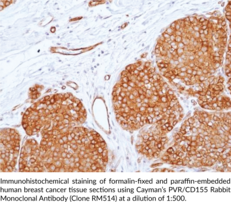 PVR/CD155 Rabbit Monoclonal Antibody (Clone RM514)