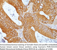 PVR/CD155 Rabbit Monoclonal Antibody (Clone RM514)