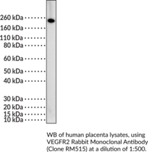 VEGFR2 Rabbit Monoclonal Antibody (Clone RM515) (CD309, Fetal Liver Kinase 1, FLK1, KDR, Kinase Insert Domain Receptor, Vascular Endothelial Growth Factor Receptor 2)