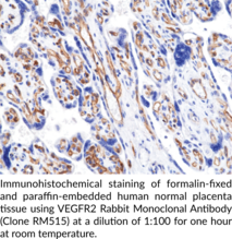 VEGFR2 Rabbit Monoclonal Antibody (Clone RM515)