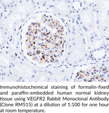 VEGFR2 Rabbit Monoclonal Antibody (Clone RM515)