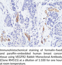 VEGFR2 Rabbit Monoclonal Antibody (Clone RM515)