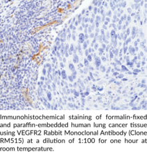VEGFR2 Rabbit Monoclonal Antibody (Clone RM515)