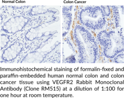 VEGFR2 Rabbit Monoclonal Antibody (Clone RM515)