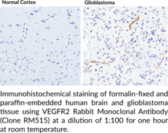 VEGFR2 Rabbit Monoclonal Antibody (Clone RM515)