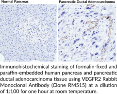 VEGFR2 Rabbit Monoclonal Antibody (Clone RM515)