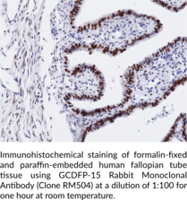 WT1 Rabbit Monoclonal Antibody (Clone RM516)