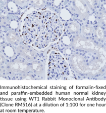 WT1 Rabbit Monoclonal Antibody (Clone RM516)