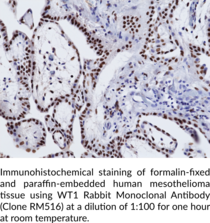 WT1 Rabbit Monoclonal Antibody (Clone RM516)