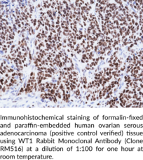 WT1 Rabbit Monoclonal Antibody (Clone RM516)