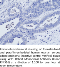 WT1 Rabbit Monoclonal Antibody (Clone RM516)