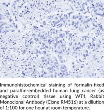 WT1 Rabbit Monoclonal Antibody (Clone RM516)