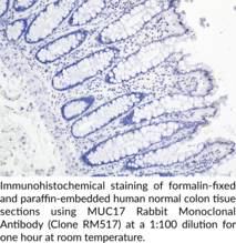 MUC17 Rabbit Monoclonal Antibody (Clone RM517)