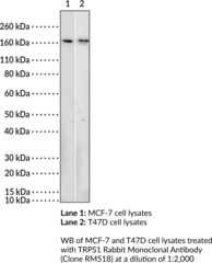 TRPS1 Rabbit Monoclonal Antibody (Clone RM518) (GC79, Trichorhinophalangeal Syndrome Type 1 Protein)