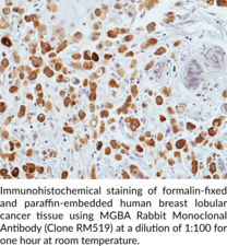 MGBA Rabbit Monoclonal Antibody (Clone RM519)