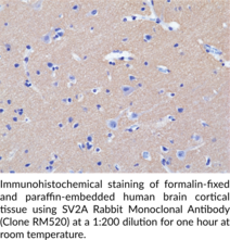 SV2A Rabbit Monoclonal Antibody (Clone RM520)