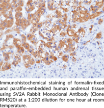 SV2A Rabbit Monoclonal Antibody (Clone RM520)