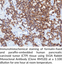 SV2A Rabbit Monoclonal Antibody (Clone RM520)